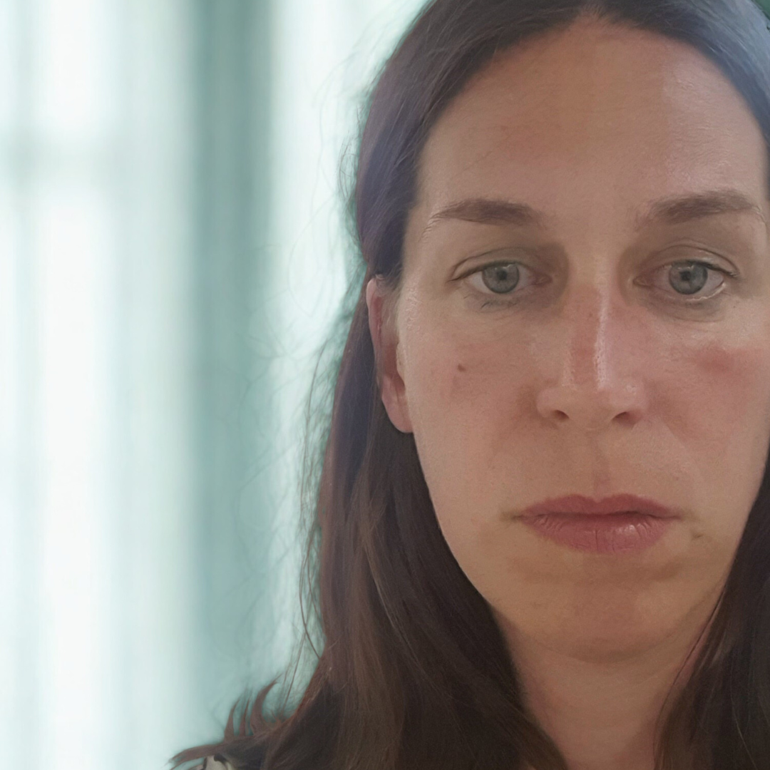 The Vulnerability of Visibility